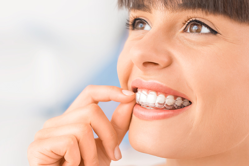 Invisalign in West Orange