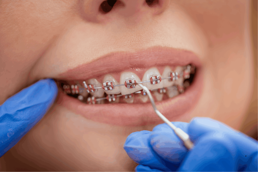 Fixed Appliances (Braces) in Newark NJ